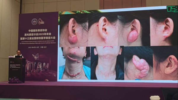 爱配投资 广州京肤疤痕修复中心朵向东医师受邀出席全国疤痕修复技术研讨会